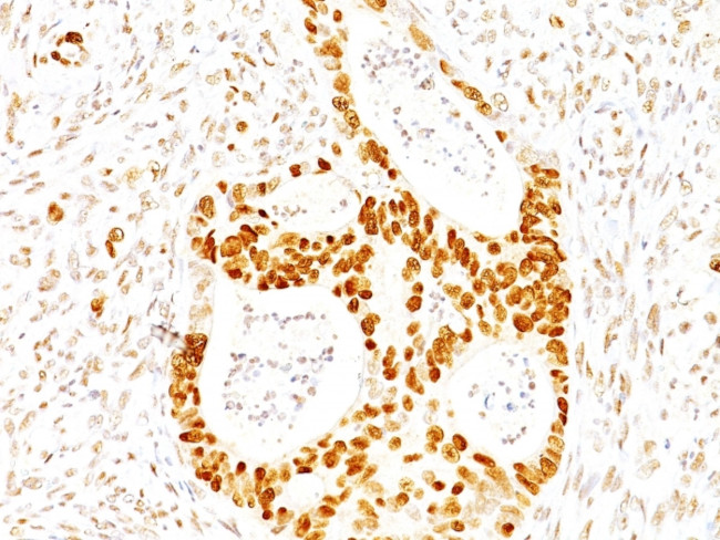 p27Kip1 (Mitotic Inhibitor/Suppressor Protein) Antibody in Immunohistochemistry (Paraffin) (IHC (P))