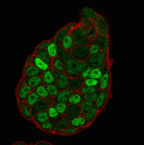 p27Kip1 (Mitotic Inhibitor/Suppressor Protein) Antibody in Immunocytochemistry (ICC/IF)