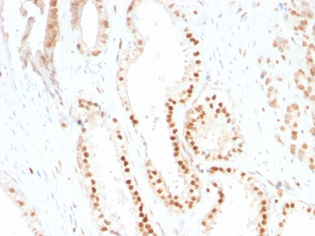 p27Kip1 (Mitotic Inhibitor/Suppressor Protein) Antibody in Immunohistochemistry (Paraffin) (IHC (P))