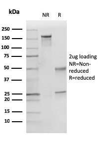 p27Kip1 (Mitotic Inhibitor/Suppressor Protein) Antibody in SDS-PAGE (SDS-PAGE)