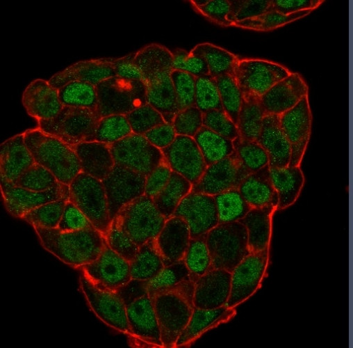 p27Kip1 (Mitotic Inhibitor/Suppressor Protein) Antibody in Immunocytochemistry (ICC/IF)