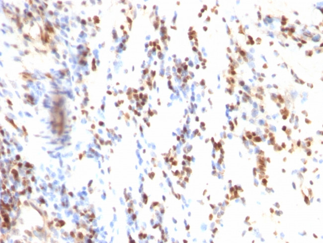 p27Kip1 (Mitotic Inhibitor/Suppressor Protein) Antibody in Immunohistochemistry (Paraffin) (IHC (P))