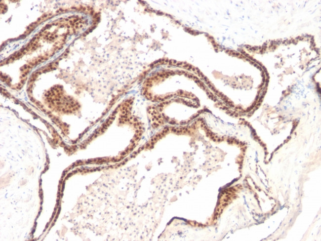 p27Kip1 (Mitotic Inhibitor/Suppressor Protein) Antibody in Immunohistochemistry (Paraffin) (IHC (P))