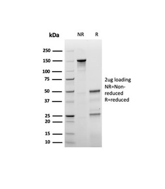 p27Kip1 (Mitotic Inhibitor/Suppressor Protein) Antibody in SDS-PAGE (SDS-PAGE)