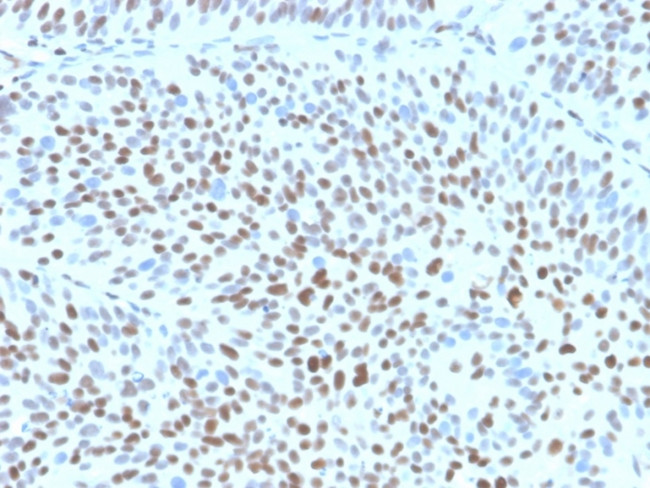 p27Kip1 (Mitotic Inhibitor/Suppressor Protein) Antibody in Immunohistochemistry (Paraffin) (IHC (P))