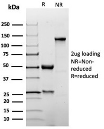 p27Kip1 (Mitotic Inhibitor/Suppressor Protein) Antibody in SDS-PAGE (SDS-PAGE)