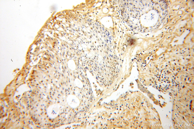 FAF1 Antibody in Immunohistochemistry (Paraffin) (IHC (P))