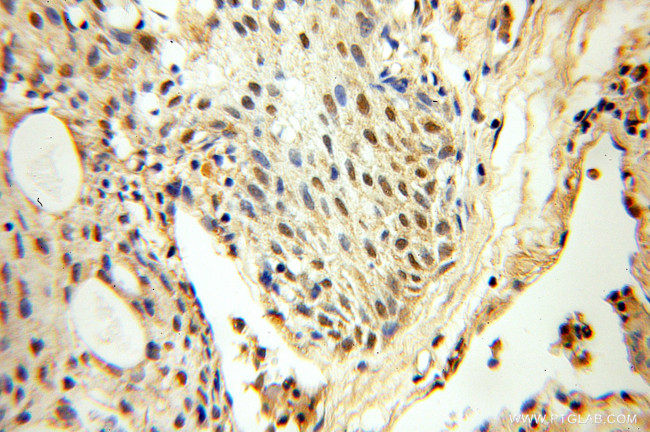 FAF1 Antibody in Immunohistochemistry (Paraffin) (IHC (P))