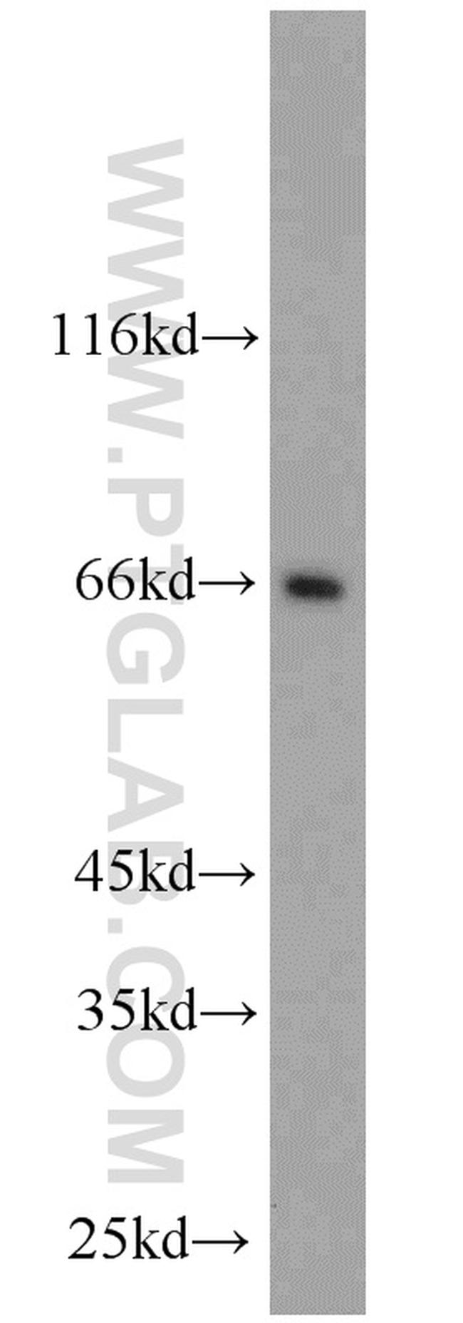 FAF1 Antibody in Western Blot (WB)