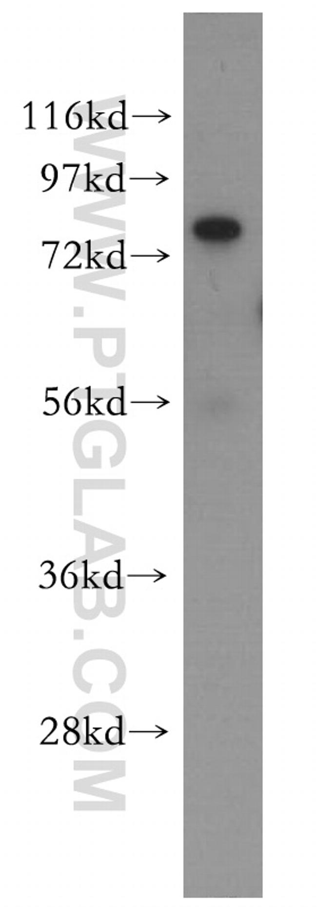 FAF1 Antibody in Western Blot (WB)