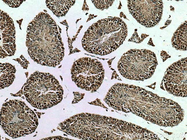 p19 INK4d Antibody in Immunohistochemistry (Paraffin) (IHC (P))