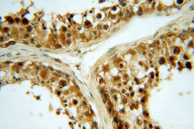 p19 INK4d Antibody in Immunohistochemistry (Paraffin) (IHC (P))