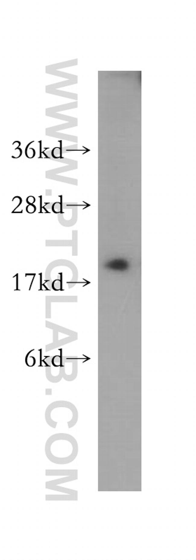 p19 INK4d Antibody in Western Blot (WB)