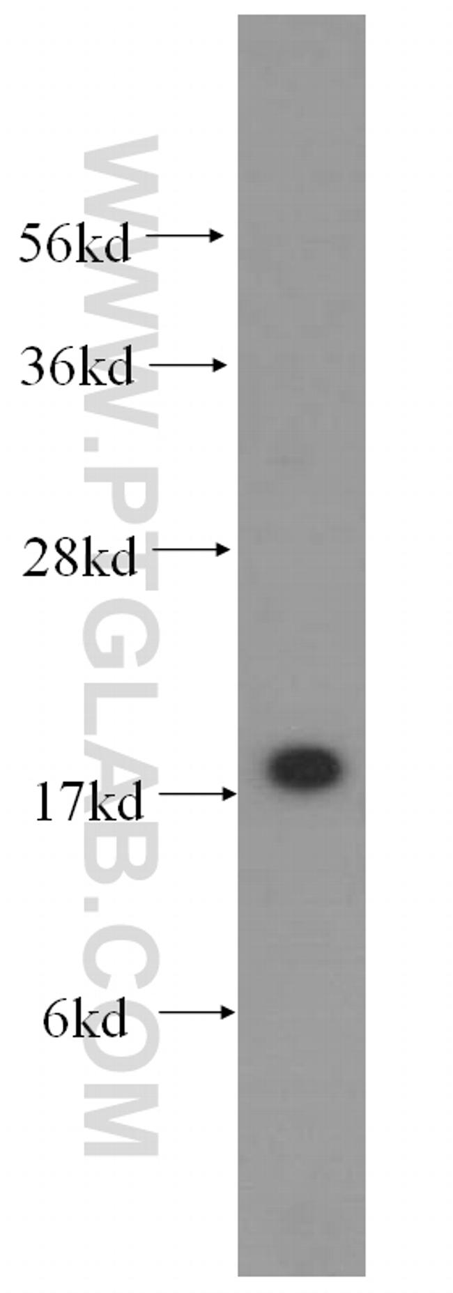 p19 INK4d Antibody in Western Blot (WB)