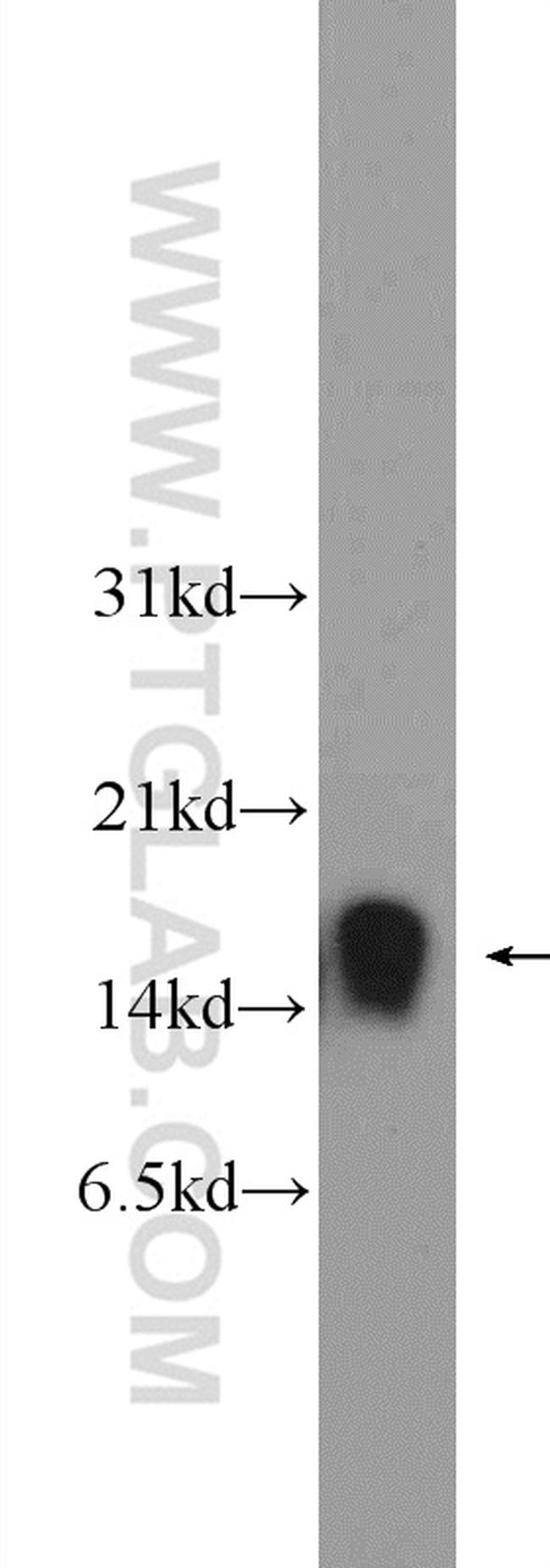 FKBP1A Antibody in Western Blot (WB)