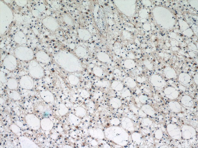 TAU Antibody in Immunohistochemistry (Paraffin) (IHC (P))