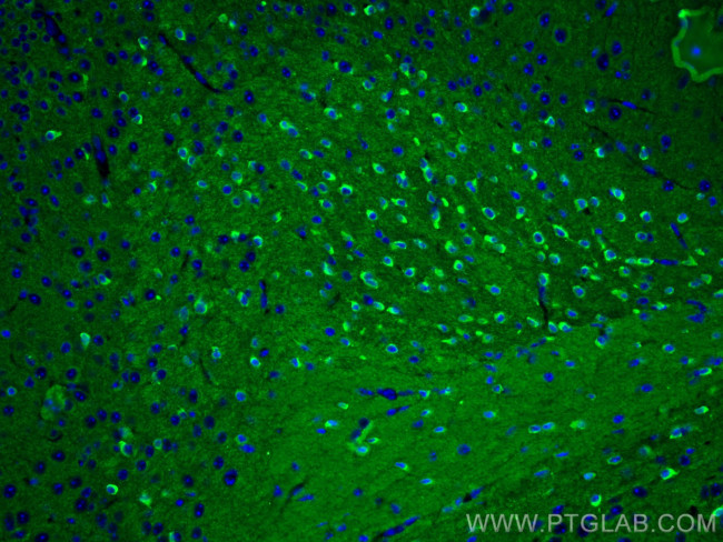 TAU Antibody in Immunohistochemistry (PFA fixed) (IHC (PFA))