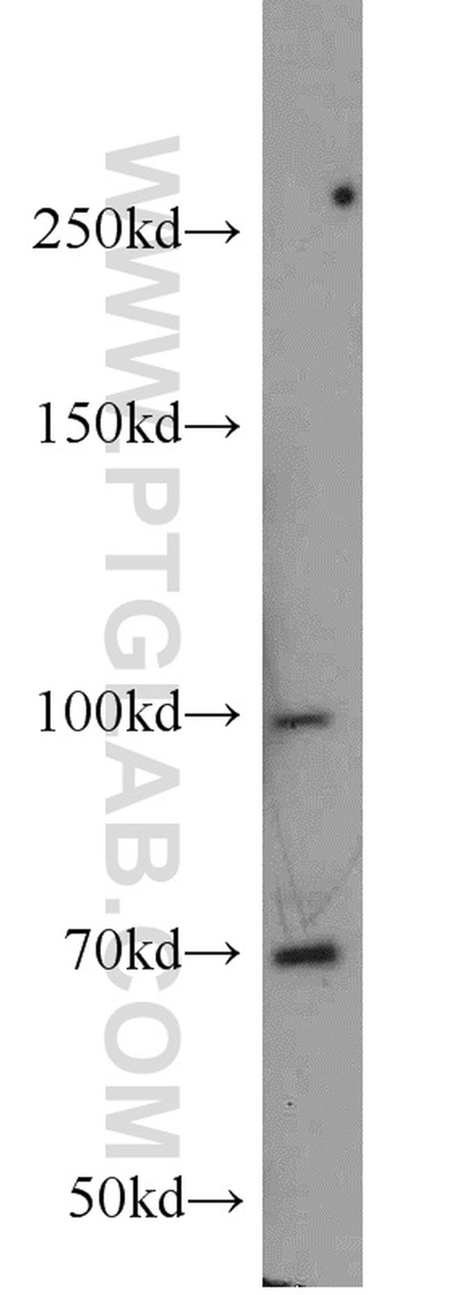 TAU Antibody in Western Blot (WB)