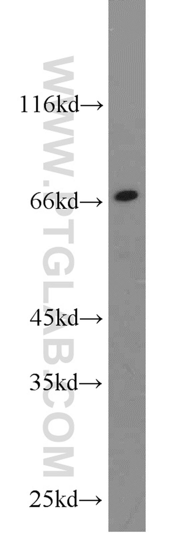 TAU Antibody in Western Blot (WB)