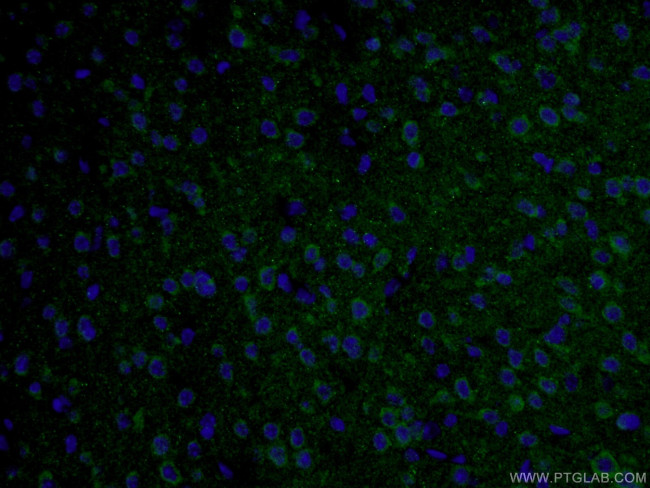 TAU Antibody in Immunohistochemistry (PFA fixed) (IHC (PFA))