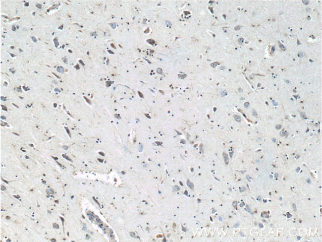 TAU Antibody in Immunohistochemistry (Paraffin) (IHC (P))