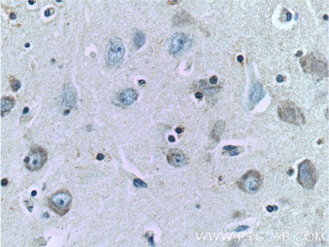 TAU Antibody in Immunohistochemistry (Paraffin) (IHC (P))