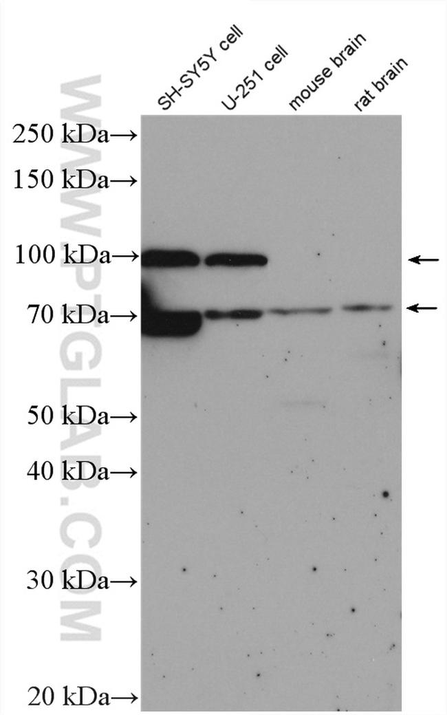 TAU Antibody in Western Blot (WB)