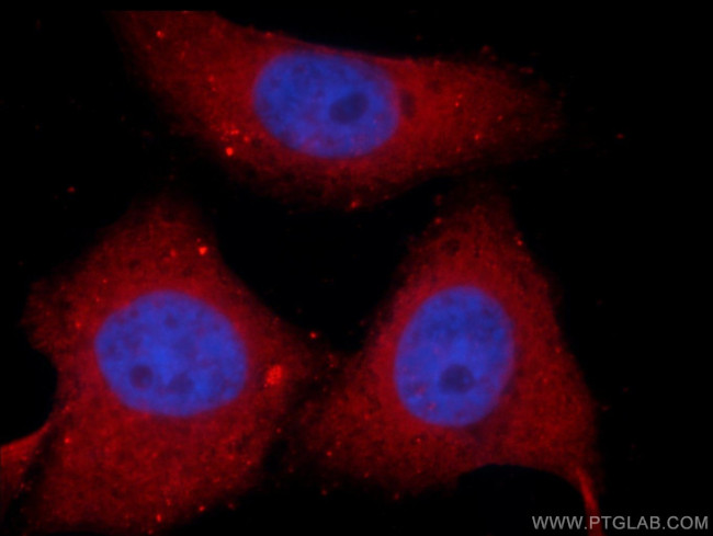 SNX17 Antibody in Immunocytochemistry (ICC/IF)