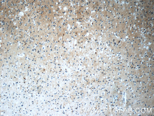 SNX17 Antibody in Immunohistochemistry (Paraffin) (IHC (P))