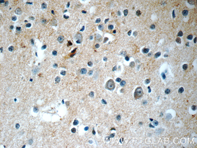 SNX17 Antibody in Immunohistochemistry (Paraffin) (IHC (P))