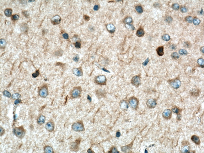 SNX17 Antibody in Immunohistochemistry (Paraffin) (IHC (P))