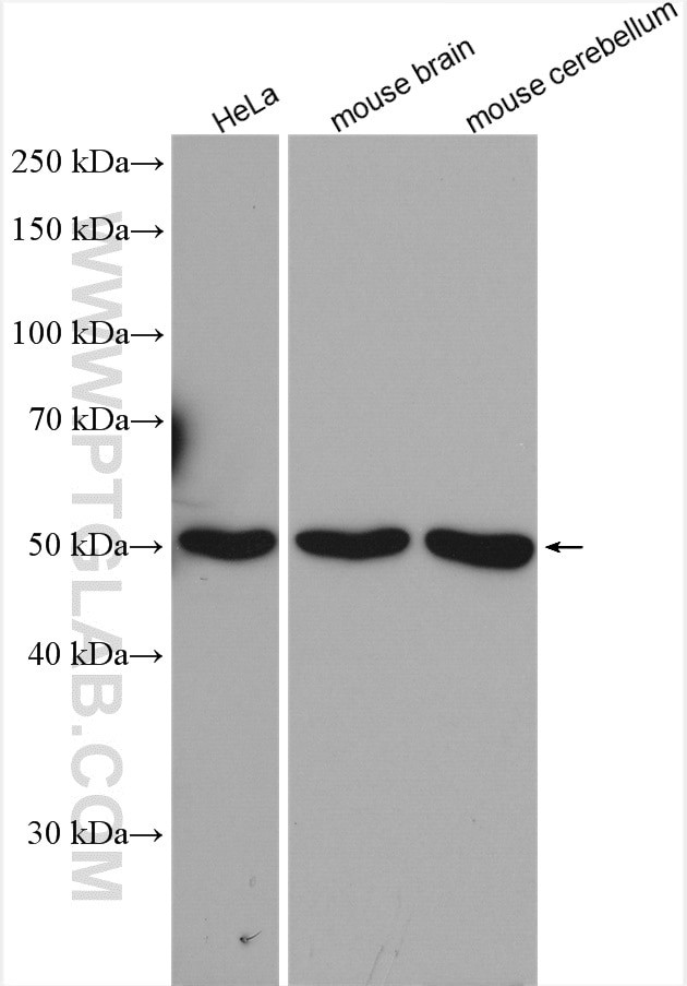 SNX17 Antibody in Western Blot (WB)