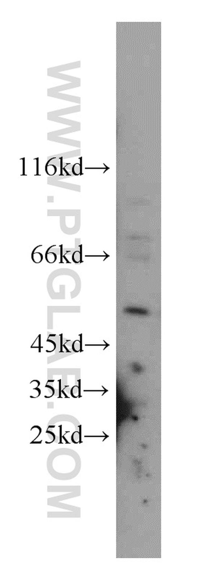 SNX17 Antibody in Western Blot (WB)