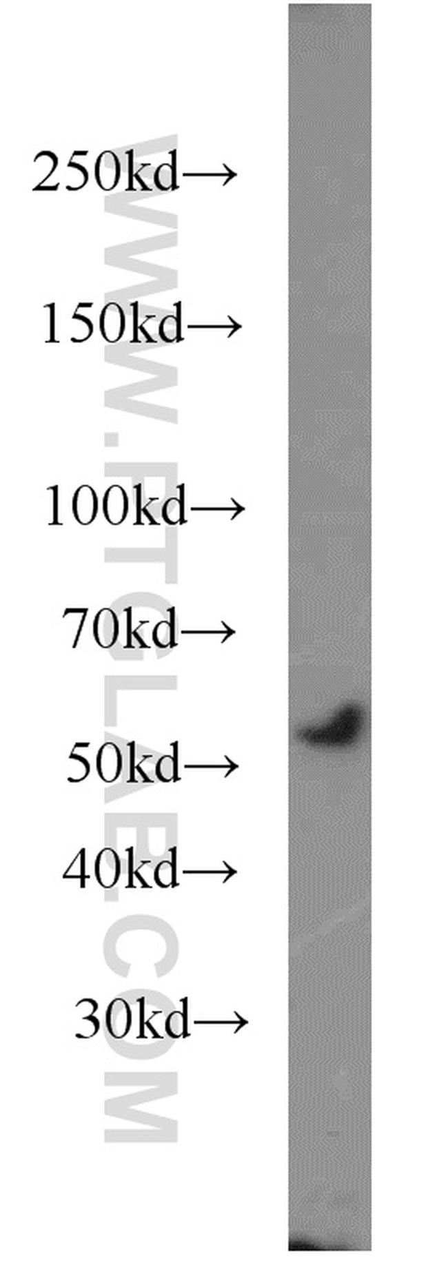 SNX17 Antibody in Western Blot (WB)