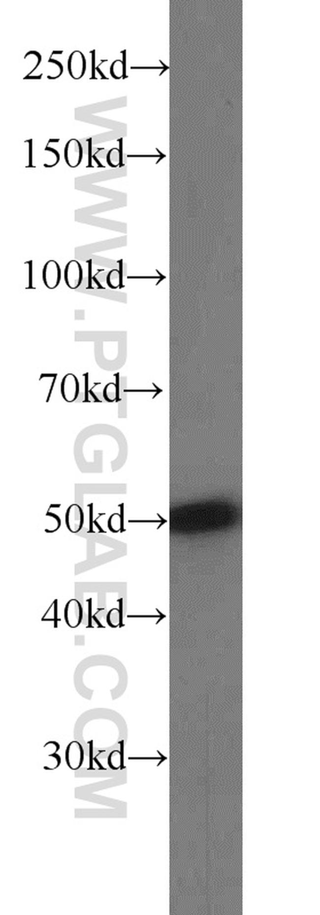 SNX17 Antibody in Western Blot (WB)