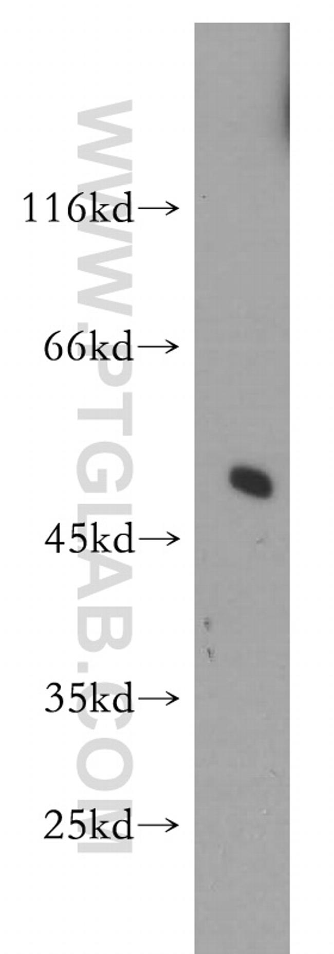 SNX17 Antibody in Western Blot (WB)