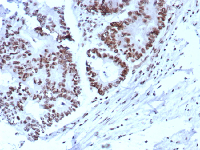 p57Kip2 (Mitotic Inhibitor/Suppressor Protein) Antibody in Immunohistochemistry (Paraffin) (IHC (P))