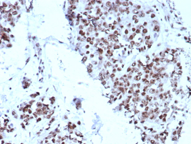 p57Kip2 (Mitotic Inhibitor/Suppressor Protein) Antibody in Immunohistochemistry (Paraffin) (IHC (P))