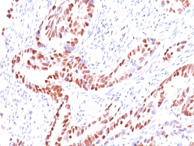 p57Kip2 (Mitotic Inhibitor/Suppressor Protein) Antibody in Immunohistochemistry (Paraffin) (IHC (P))