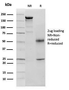 p57Kip2 (Mitotic Inhibitor/Suppressor Protein) Antibody in SDS-PAGE (SDS-PAGE)