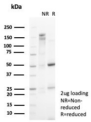 p57Kip2 (Mitotic Inhibitor/Suppressor Protein) Antibody in SDS-PAGE (SDS-PAGE)