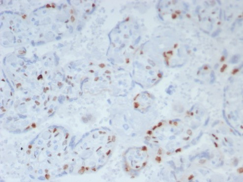 p57Kip2 (Mitotic Inhibitor/Suppressor Protein) Antibody in Immunohistochemistry (Paraffin) (IHC (P))