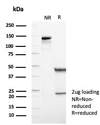 p57Kip2 (Mitotic Inhibitor/Suppressor Protein) Antibody in SDS-PAGE (SDS-PAGE)