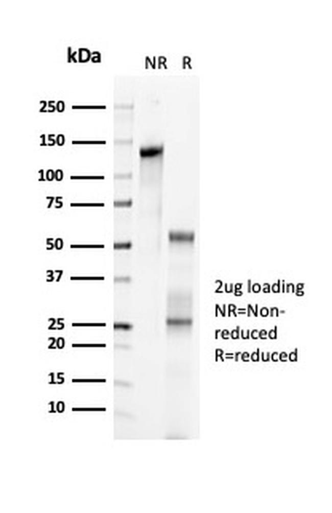 p57Kip2 (Mitotic Inhibitor/Suppressor Protein) Antibody in Immunoelectrophoresis (IE)