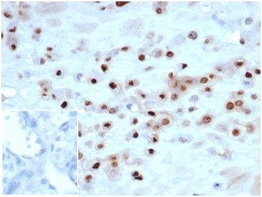 p57Kip2 (Mitotic Inhibitor/Suppressor Protein) Antibody in Immunohistochemistry (Paraffin) (IHC (P))