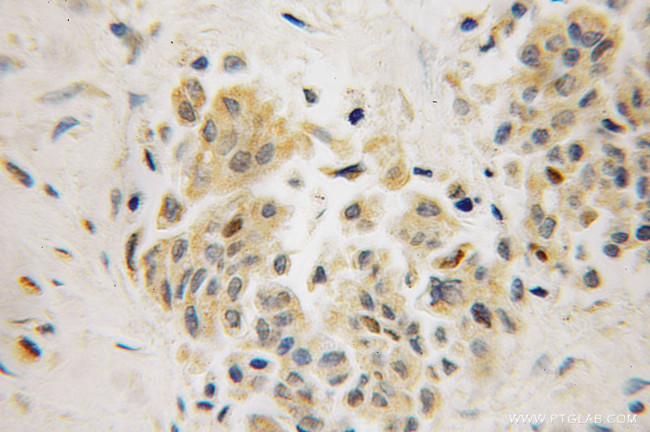 MAGEC2 Antibody in Immunohistochemistry (Paraffin) (IHC (P))