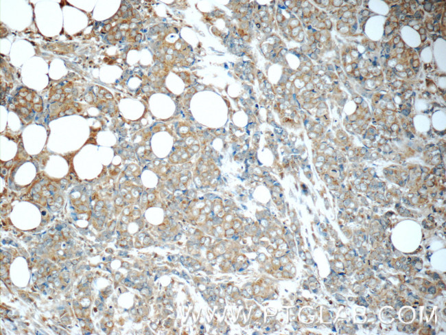 MAGEC2 Antibody in Immunohistochemistry (Paraffin) (IHC (P))