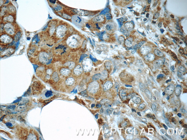 MAGEC2 Antibody in Immunohistochemistry (Paraffin) (IHC (P))