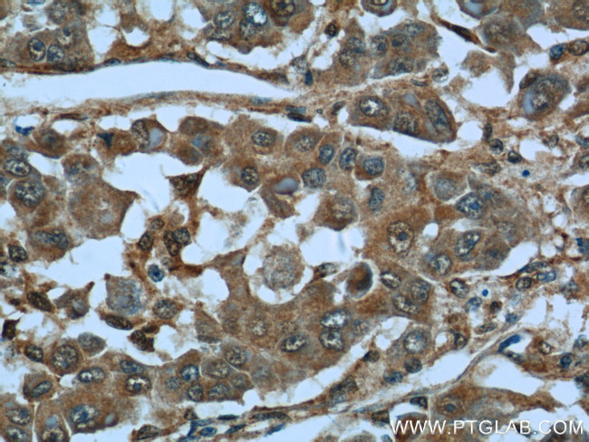 MAGEC2 Antibody in Immunohistochemistry (Paraffin) (IHC (P))