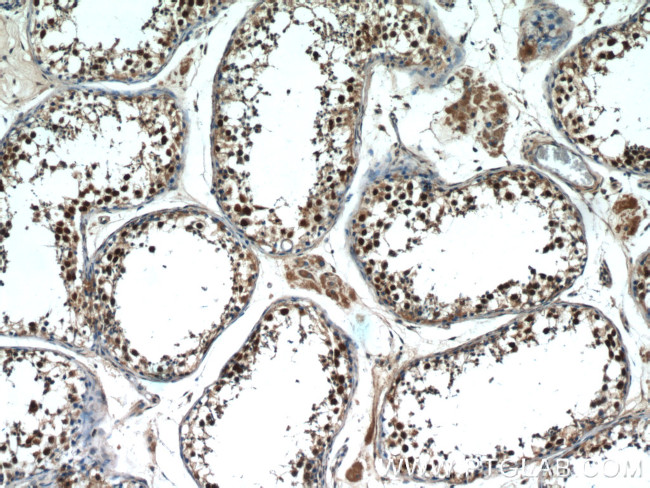 MAGEC2 Antibody in Immunohistochemistry (Paraffin) (IHC (P))